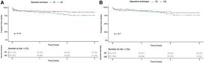 Stroke and pump thrombosis following left ventricular assist device implantation: The impact of the implantation technique